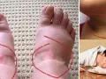 Niski poziom insuliny objawy – jak je rozpoznać i co oznaczają?