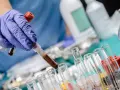 Ręka w niebieskiej rękawiczce trzyma probówkę z ciemnym płynem, prawdopodobnie badanie bilirubina całkowita. W tle inne probówki i butelki laboratoryjne.