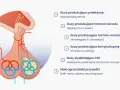 Ilustracja przysadki mózgowej z listą różnych guzów i ich objawów, np. guz przysadki mózgowej objawy.