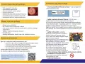 Czynniki ryzyka raka jelita grubego: wiek, genetyka, polipy, choroby zapalne, siedzący tryb życia, dieta, alkohol, papierosy. Objawy i profilaktyka.