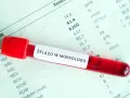Probówka z krwią na tle wyników badań laboratoryjnych z napisem "Żelazo w morfologii".
