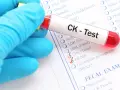 Ręka w niebieskiej rękawiczce trzyma probówkę z krwią do testu CK. Na formularzu zaznaczono CK-MB, co może wskazywać na badanie kinazy kreatynowej.