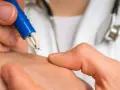Lekarz chorób zakaźnych - co naprawdę robi i jakie choroby leczy?