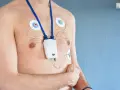Mężczyzna z przyklejonymi elektrodami i urządzeniem holter ekg na szyi, monitorującym pracę serca.