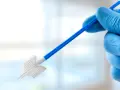 Ręka w niebieskiej rękawiczce trzyma niebiesko-biały przyrząd do pobierania wymazów. To narzędzie jest kluczowe w badaniach, takich jak cytologia, co to jest i jak działa.