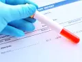 Ręka w niebieskiej rękawiczce trzyma probówkę z krwią nad raportem laboratoryjnym. Wynik ferrytyny 62.3 ng/mL mieści się w normie.