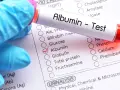 Rękawiczka w niebieskiej rękawiczce trzyma probówkę z napisem "Albumin - Test". Obok zaznaczono pole "Albumin" na liście badań.