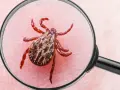 Kleszcz pod lupą, przypominający o zagrożeniu kleszczowym zapaleniem mózgu.