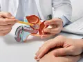 Lekarz omawia z pacjentem model układu moczowo-płciowego, wskazując na obszar prostaty, co może dotyczyć problemów z zapaleniem prostaty.