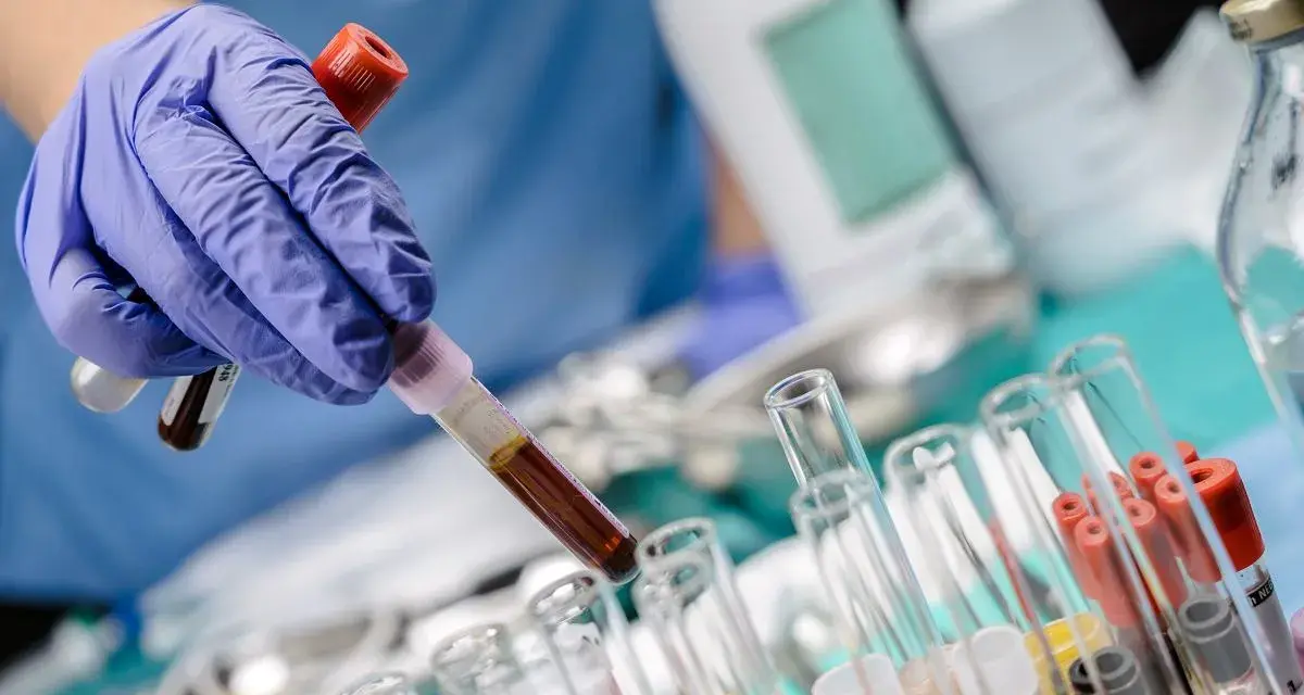 Ręka w niebieskiej rękawiczce trzyma probówkę z ciemnym płynem, prawdopodobnie badanie bilirubina całkowita. W tle inne probówki i butelki laboratoryjne.