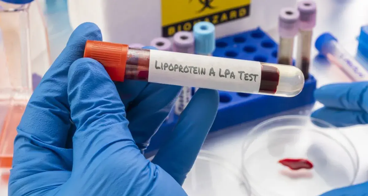 Badanie lipoproteiny A (LPA) to analiza krwi oceniająca ryzyko chorób serca.