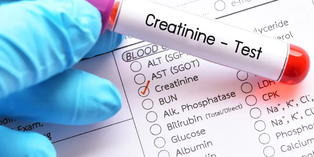 Rękawiczka w niebieskiej rękawiczce trzyma probówkę z napisem "Creatinine - Test". Obok zaznaczono "Creatinine", sugerując badanie poziomu kreatyniny w normie.