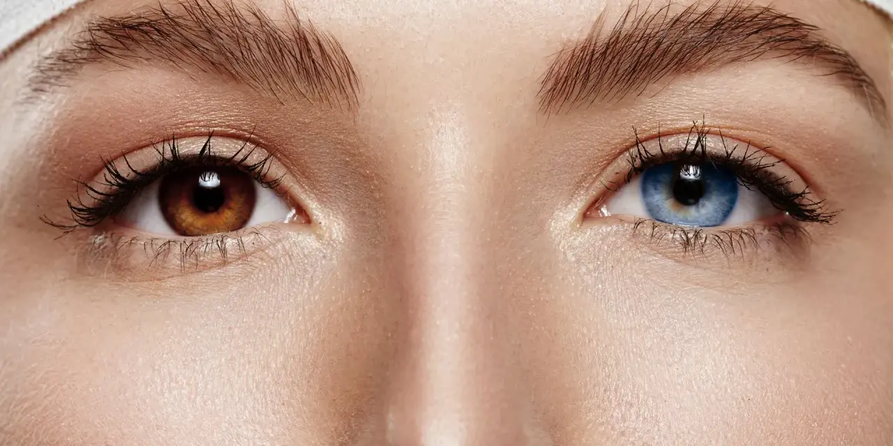 Oczy z heterochromią: jedno brązowe, drugie niebieskie. Delikatna opaska na głowie.