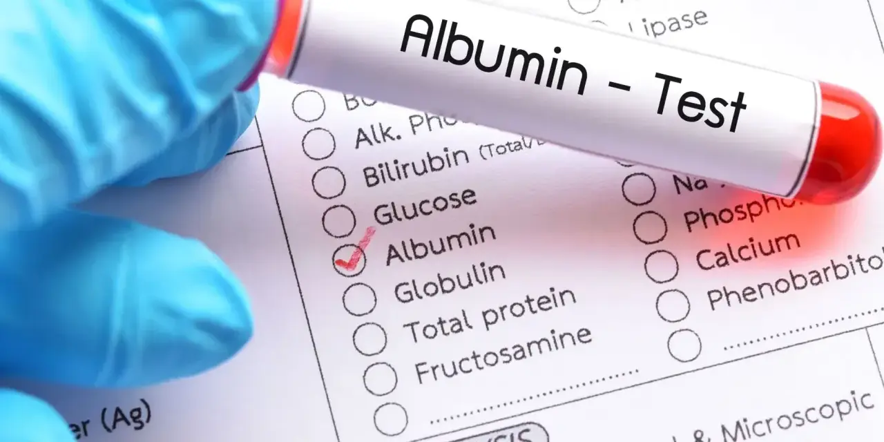 Rękawiczka w niebieskiej rękawiczce trzyma probówkę z napisem "Albumin - Test". Obok zaznaczono pole "Albumin" na liście badań.