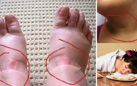 Niski poziom insuliny objawy – jak je rozpoznać i co oznaczają?