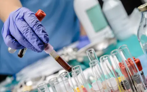 Ręka w niebieskiej rękawiczce trzyma probówkę z ciemnym płynem, prawdopodobnie badanie bilirubina całkowita. W tle inne probówki i butelki laboratoryjne.