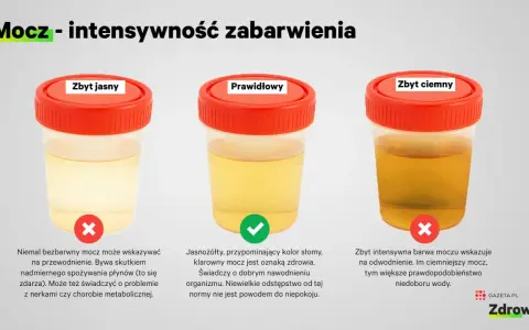 Pojemniki z moczem o różnym zabarwieniu: zbyt jasny, prawidłowy, zbyt ciemny. Zbyt jasny mocz może wskazywać na przewodnienie, a zbyt ciemny na odwodnienie. Pasma śluzu w moczu nie są widoczne na tym obrazie.