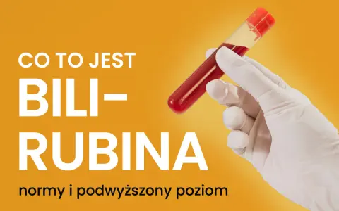 Ręka w rękawiczce trzyma probówkę z krwią. Tekst informuje o tym, czym jest bilirubina i kiedy jej poziom jest podwyższony.