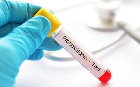 Ręka w niebieskiej rękawiczce trzyma probówkę z napisem "Procalcitonin - Test". To ważny pct.