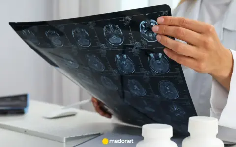 Lekarz analizuje obraz rezonansu magnetycznego mózgu, szukając oznak glejaka.
