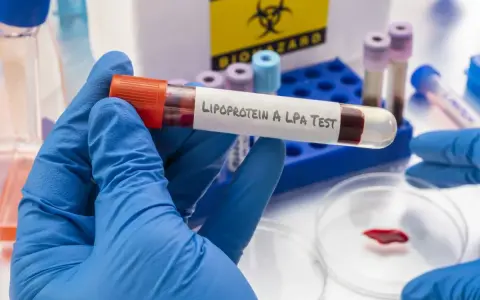 Badanie lipoproteiny A (LPA) to analiza krwi oceniająca ryzyko chorób serca.