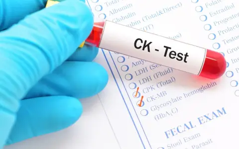 Ręka w niebieskiej rękawiczce trzyma probówkę z krwią do testu CK. Na formularzu zaznaczono CK-MB, co może wskazywać na badanie kinazy kreatynowej.