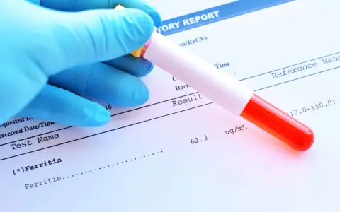 Ręka w niebieskiej rękawiczce trzyma probówkę z krwią nad raportem laboratoryjnym. Wynik ferrytyny 62.3 ng/mL mieści się w normie.