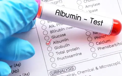 Rękawiczka w niebieskiej rękawiczce trzyma probówkę z napisem "Albumin - Test". Obok zaznaczono pole "Albumin" na liście badań.
