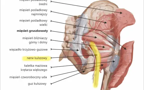 Jak złagodzić ból pośladków po zastrzykach – skuteczne sposoby i porady