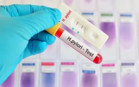 Rękawiczka trzyma probówkę z krwią i test H. pylori. Czasem objawy psychiczne mogą być związane z tą infekcją.