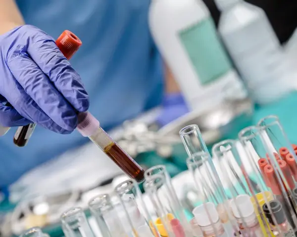 Ręka w niebieskiej rękawiczce trzyma probówkę z ciemnym płynem, prawdopodobnie badanie bilirubina całkowita. W tle inne probówki i butelki laboratoryjne.