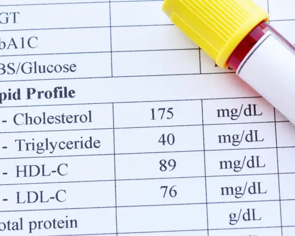 Wynik lipidogramu: cholesterol 175, trójglicerydy 40, HDL-C 89, LDL-C 76 mg/dL. To badanie ocenia poziom tłuszczów we krwi.