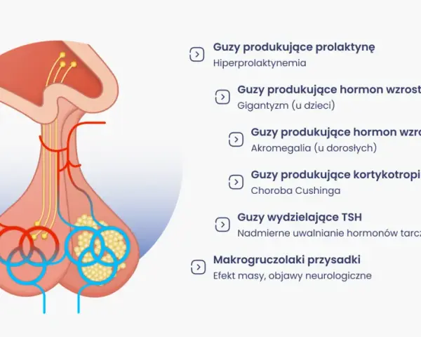 Ilustracja przysadki mózgowej z listą różnych guzów i ich objawów, np. guz przysadki mózgowej objawy.
