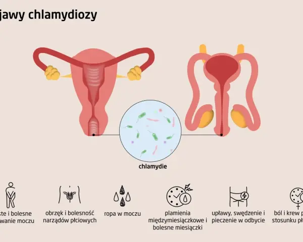 Ilustracja przedstawia układ rozrodczy kobiety i mężczyzny, z powiększeniem ukazującym bakterie chlamydii. Wymienione objawy chlamydiozy to m.in. ból przy oddawaniu moczu i plamienia.