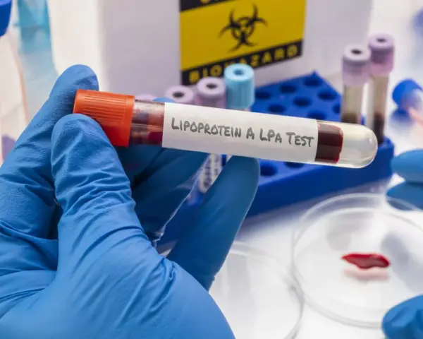 Badanie lipoproteiny A (LPA) to analiza krwi oceniająca ryzyko chorób serca.