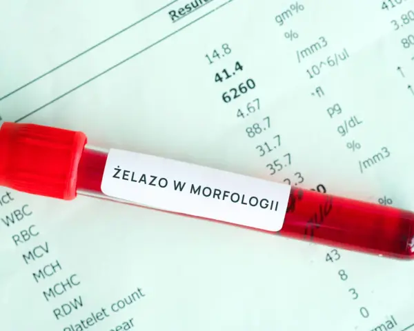 Probówka z krwią na tle wyników badań laboratoryjnych z napisem "Żelazo w morfologii".