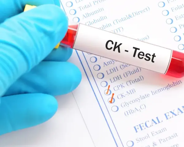 Ręka w niebieskiej rękawiczce trzyma probówkę z krwią do testu CK. Na formularzu zaznaczono CK-MB, co może wskazywać na badanie kinazy kreatynowej.