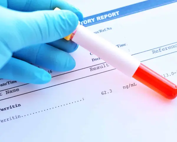 Ręka w niebieskiej rękawiczce trzyma probówkę z krwią nad raportem laboratoryjnym. Wynik ferrytyny 62.3 ng/mL mieści się w normie.