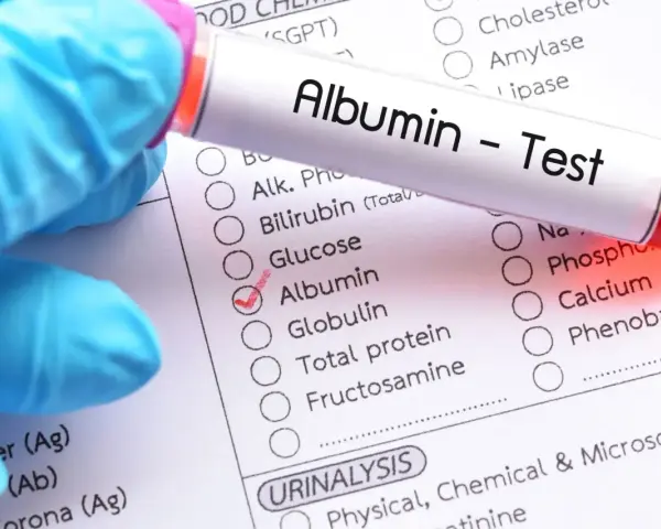 Rękawiczka w niebieskiej rękawiczce trzyma probówkę z napisem "Albumin - Test". Obok zaznaczono pole "Albumin" na liście badań.
