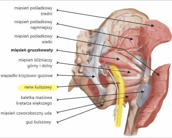 Jak złagodzić ból pośladków po zastrzykach – skuteczne sposoby i porady
