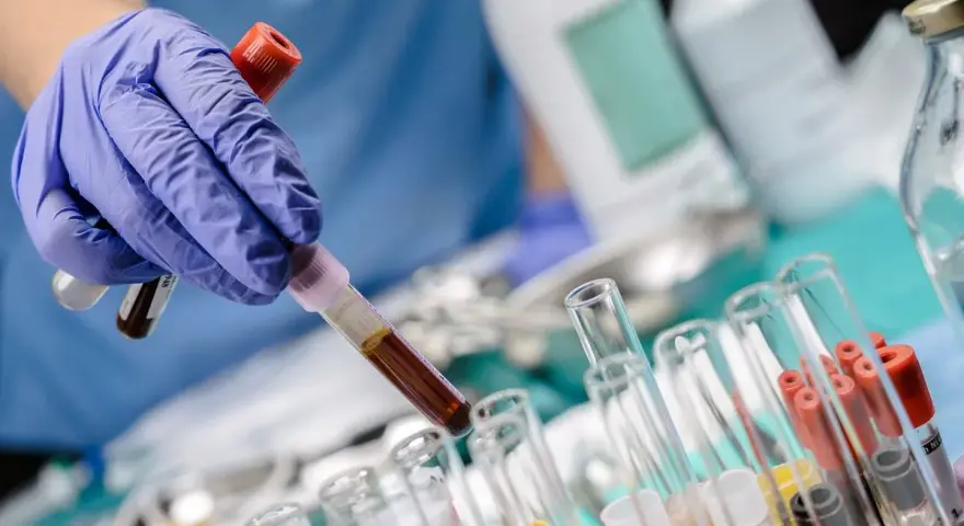 Ręka w niebieskiej rękawiczce trzyma probówkę z ciemnym płynem, prawdopodobnie badanie bilirubina całkowita. W tle inne probówki i butelki laboratoryjne.
