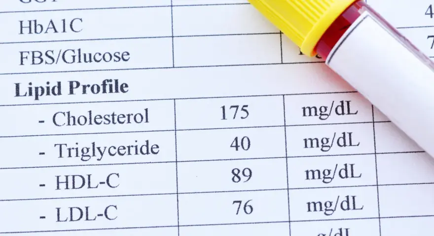 Wynik lipidogramu: cholesterol 175, trójglicerydy 40, HDL-C 89, LDL-C 76 mg/dL. To badanie ocenia poziom tłuszczów we krwi.