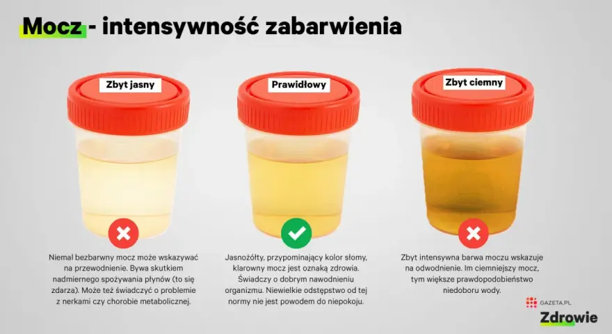 Pojemniki z moczem o różnym zabarwieniu: zbyt jasny, prawidłowy, zbyt ciemny. Zbyt jasny mocz może wskazywać na przewodnienie, a zbyt ciemny na odwodnienie. Pasma śluzu w moczu nie są widoczne na tym obrazie.