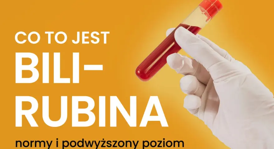 Ręka w rękawiczce trzyma probówkę z krwią. Tekst informuje o tym, czym jest bilirubina i kiedy jej poziom jest podwyższony.