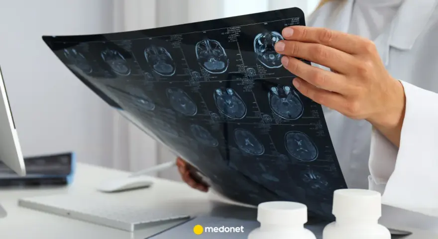 Lekarz analizuje obraz rezonansu magnetycznego mózgu, szukając oznak glejaka.