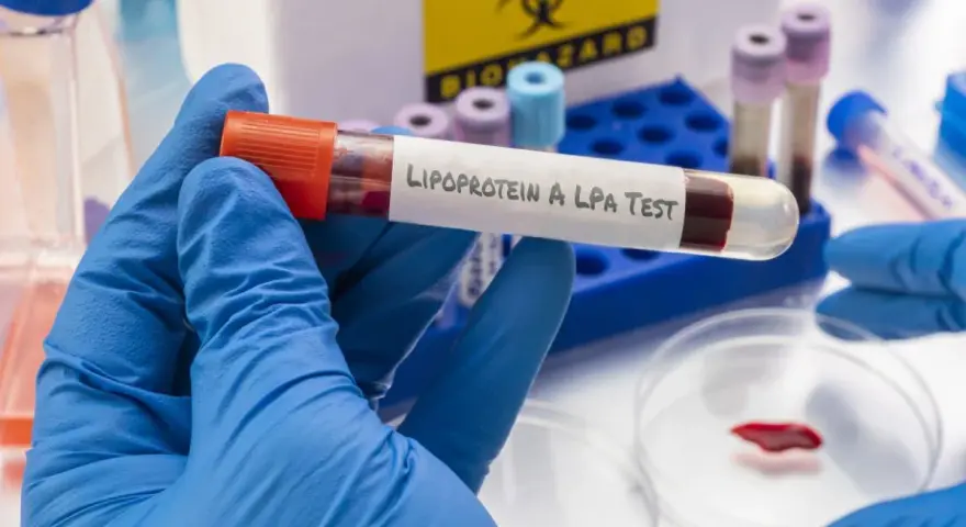 Badanie lipoproteiny A (LPA) to analiza krwi oceniająca ryzyko chorób serca.