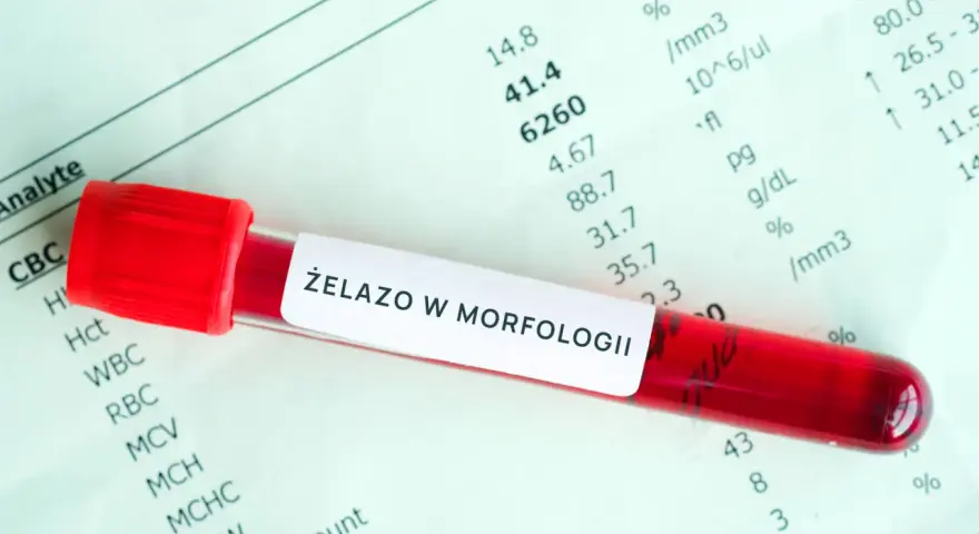 Probówka z krwią na tle wyników badań laboratoryjnych z napisem "Żelazo w morfologii".