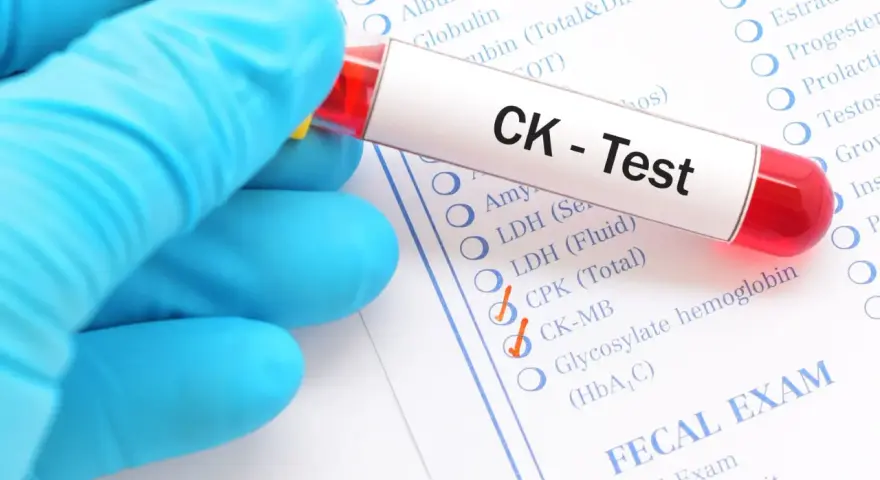 Ręka w niebieskiej rękawiczce trzyma probówkę z krwią do testu CK. Na formularzu zaznaczono CK-MB, co może wskazywać na badanie kinazy kreatynowej.