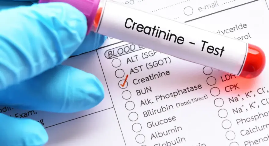 Rękawiczka w niebieskiej rękawiczce trzyma probówkę z napisem "Creatinine - Test". Obok zaznaczono "Creatinine", sugerując badanie poziomu kreatyniny w normie.