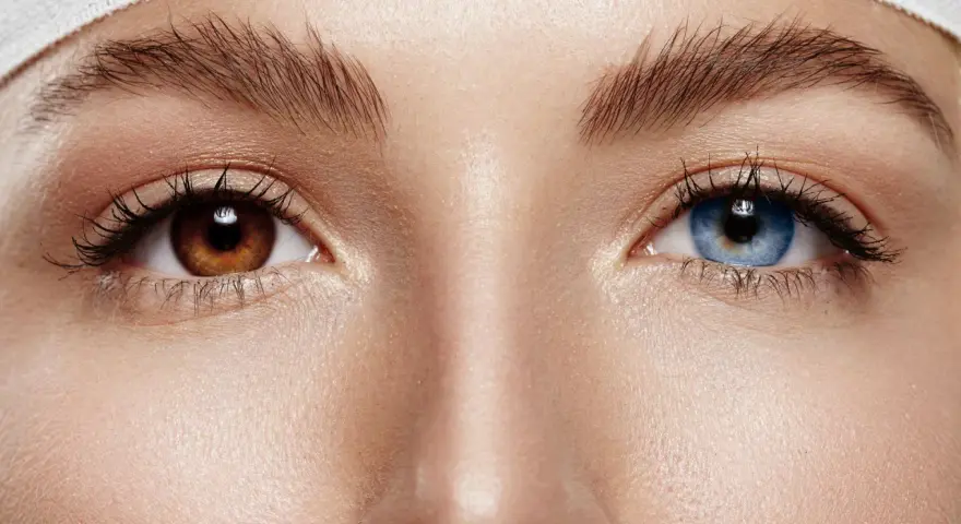 Oczy z heterochromią: jedno brązowe, drugie niebieskie. Delikatna opaska na głowie.